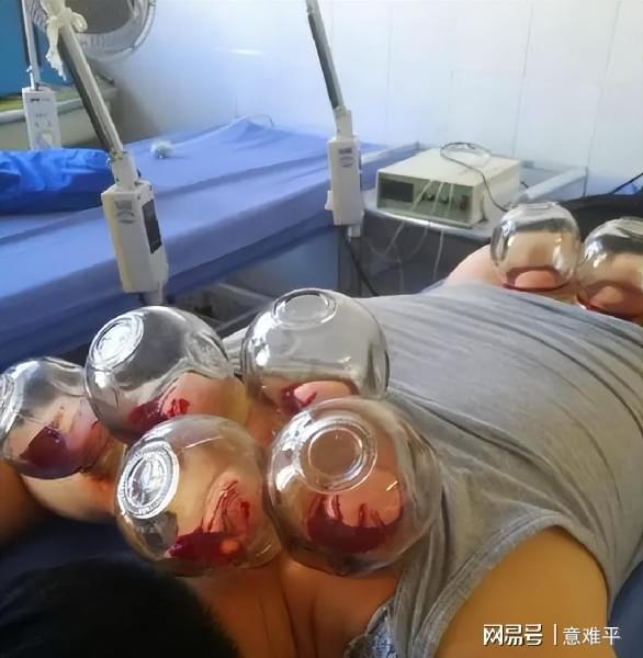 美容院拔罐变身紫薯精，自然与心灵的奇妙交融之旅