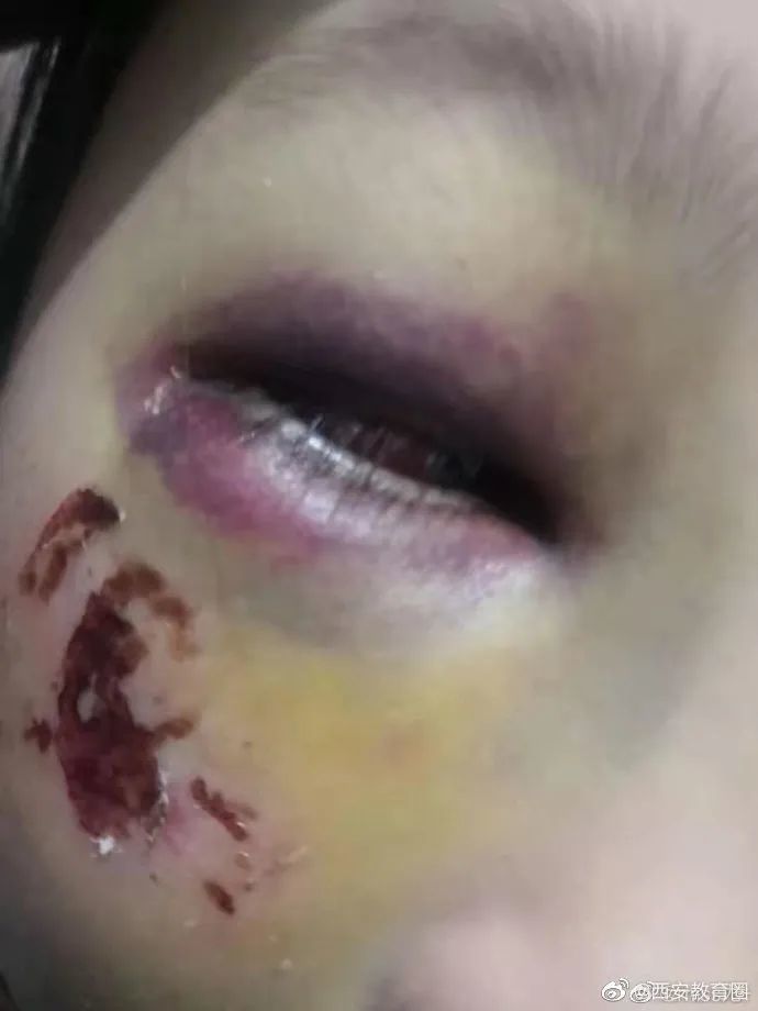 警方回应教练疑故意抽球击打女孩脸部事件，绿色旅行寻求内心平静之路